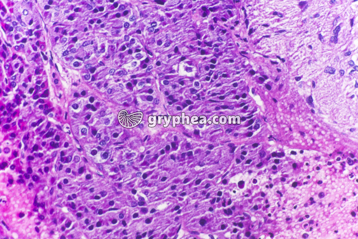 Hypophyse médiane x100 - gryphea.com